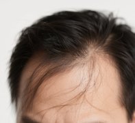 洗發(fā)水成分揭發(fā)！小心這些洗發(fā)水有害成